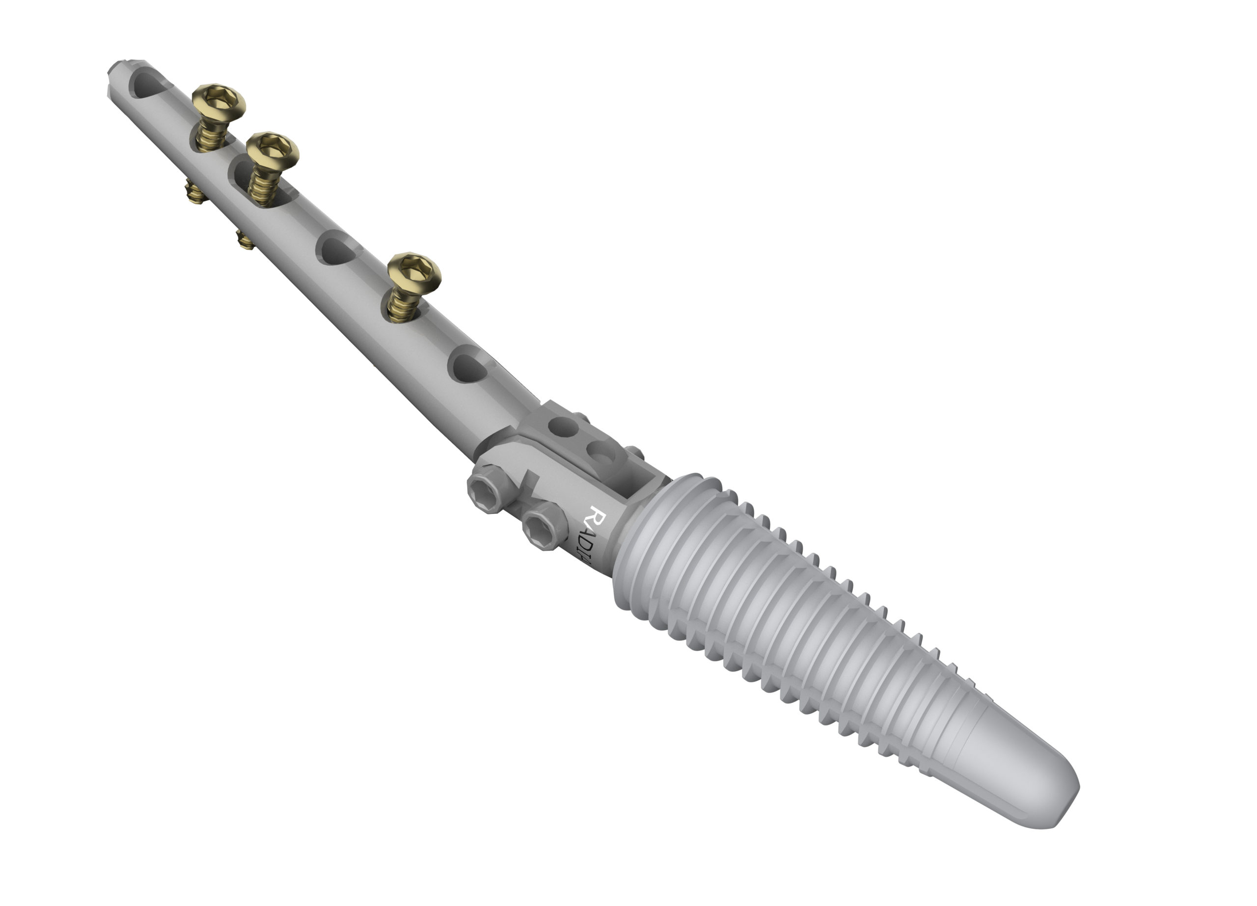 Motec Wrist Arthrodesis - Nail + Connector